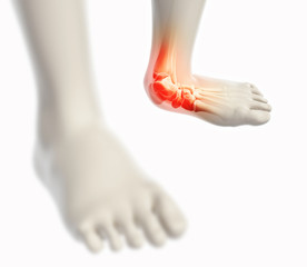 Ankle painful - skeleton x-ray.