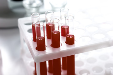 glass tubes with blood sample in stand no one