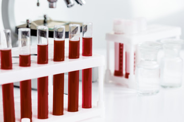 blood in glass tubes on background of microscope