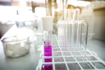 laboratory test tube with soft focus