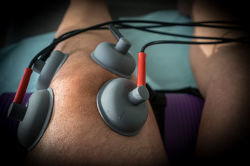 suction cups applied to a knee in physiotherapy