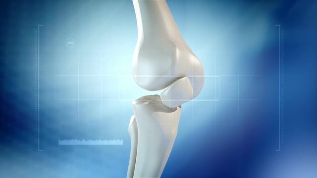 Knee pain animation. Three High Quality animations of Knee pain.