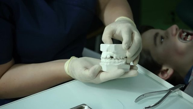 Orthodontic Treatment. Bite correction. Orthodontist at work. Open-mouthed teenage boy lying in the dental chair while the orthodontist is attaching the braces on teeth. HD