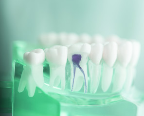 Fototapeta na wymiar Dental tooth root model