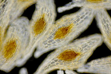 Terrestrial orchid seeds