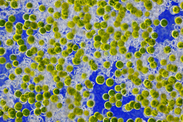 Horsetail (Equisetum arvense) spores with elaters