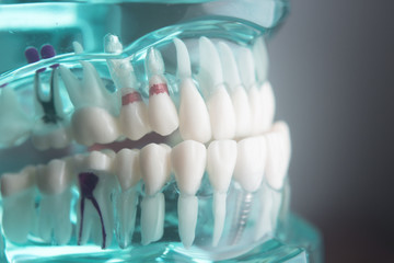 Dental teeth dentistry model