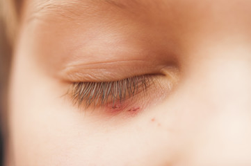 Obraz premium child's eye - macro