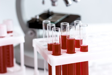 Medical equipment blood test in laboratory no one