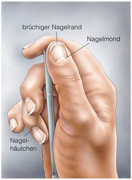 Nagelaufbau.Br&uuml;chige N&auml;gel