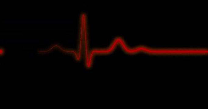 EKG Line / EKG Monitor / EKG Machine / Heart Health. Red ECG monitor shows the heart beat. The heart stops for three seconds and starts again.