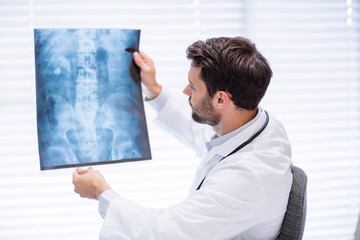 Male doctor examining x-ray
