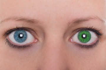 Frau mit Iris Heterochromie, Augenfarbe grün und blau, Kontaktl