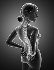 Women Feeling the Back pain