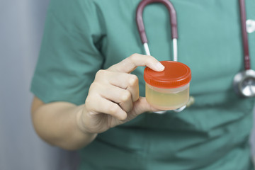 Medical,Healthcare And Medicine. Medical urine test, close-up of Doctor hand with urine container.selective focus..