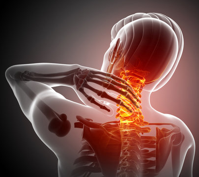 Male Feeling the Neck Pain