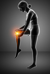 Women Knee joint pain