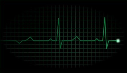 Simple green electrocardiograph display