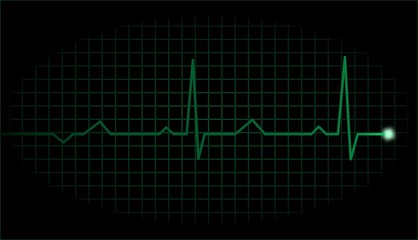 Simple green electrocardiograph display