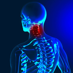 3d render of a medical image with painful shoulder,elbow and spi