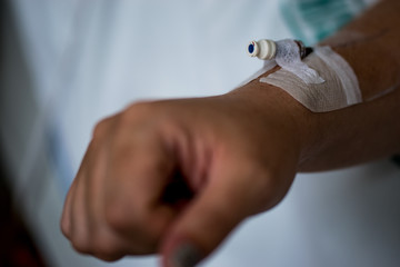 Cannula in right arm of a caucasian female held down by tape as a surgical aid to administer drugs / IV Intravenous drip / take blood from a patient inserted into a vein in hospital soft focus on hand
