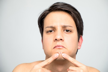 young man squeezing a pimple, men's skincare concept