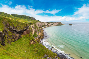 Carrick-a-Rede, Causeway Coast