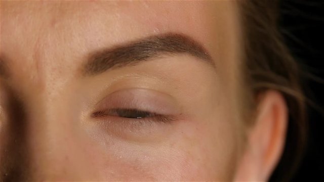 Girl opens her eyes and her eyes are very sore and swollen. Slow motion