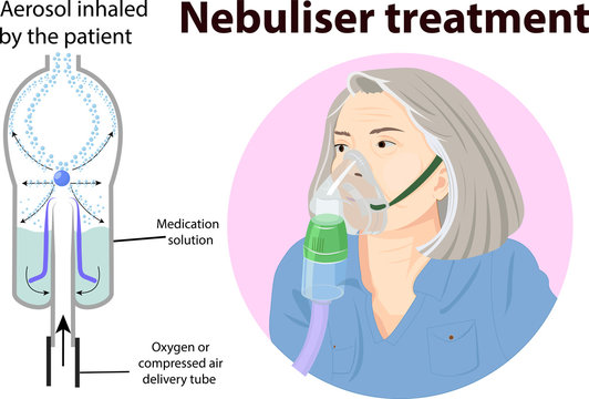 Vector illustration of nebuliser treatment anatomy