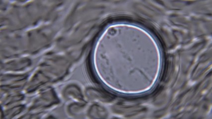 Footage on the theme blood, diseases, interstitial fluid, bacterial background, research using a microscope at extreme magnification of about 1000x