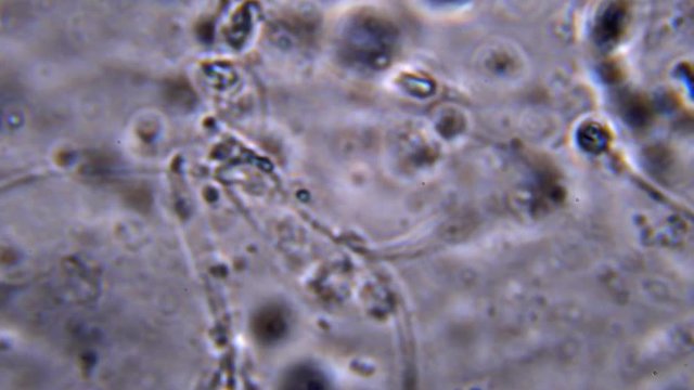 Seeing sperm activity using a microscope at extreme magnification about 1000x