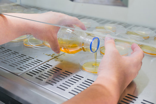 Pour plate technique for MacConkey agar Bacteria culture.