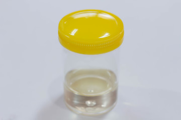 Urine sample