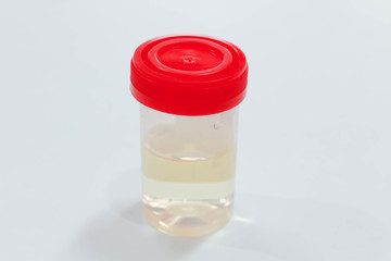 Urine sample