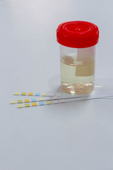 Urine sample