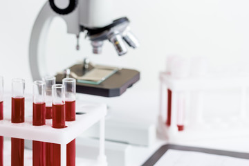 blood in glass tubes on background of microscope