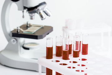 blood in glass tubes on background of microscope