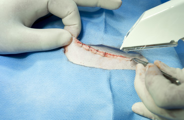 Veterinaian and surgeon stitch up te wound of dog using skin stapler