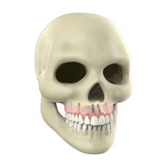 3D rendering implant
