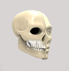 3D rendering implant