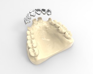3D rendering dentures