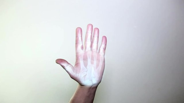 X-ray of hand. Full HD