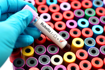 Fototapeta premium Rubella positive
