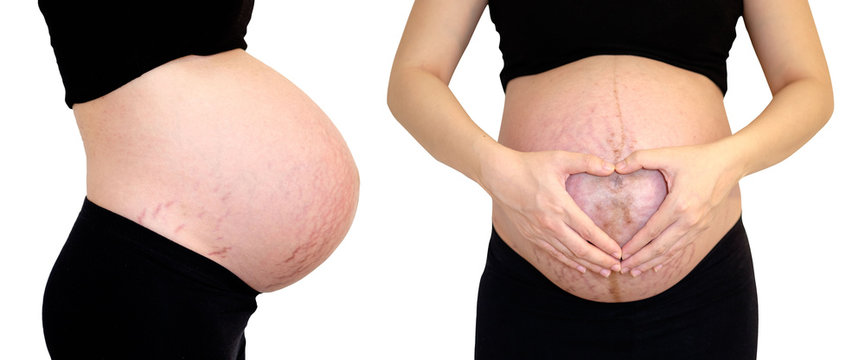 Pregnant woman 40 weeks, Pregnant, Close up of a cute pregnant belly, Isolate and Clipping Path