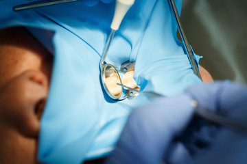Patient getting dental treatment with dental rubber dam protection