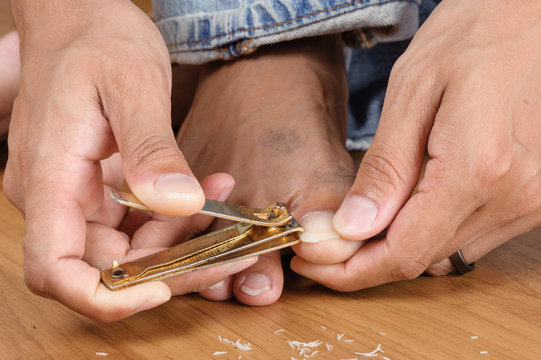 Trimming Nails