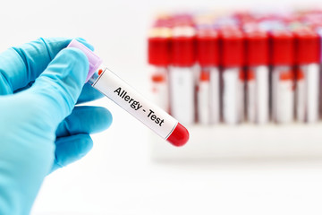 Blood sample for allergy test