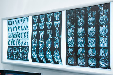Several resonance imaging (MRI) of the brain. Selective focus
