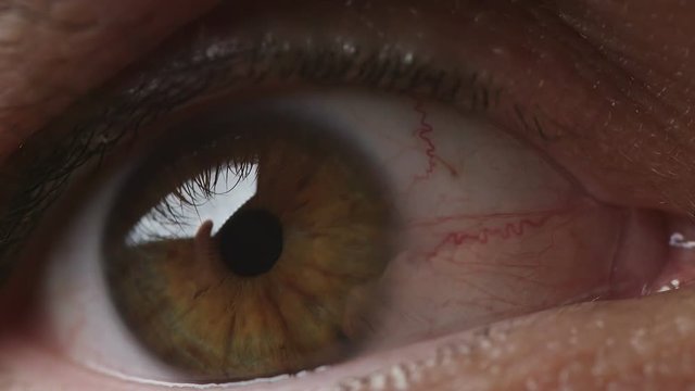 Large bloodshot males eye filmed in extreme closeup