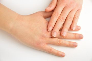 hands touching with dry skin